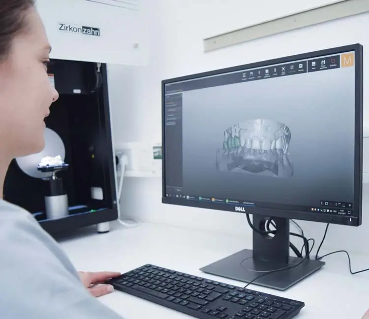 Detailaufnahme des Computerbildschirms mit dem Scan eines 3D-Modells